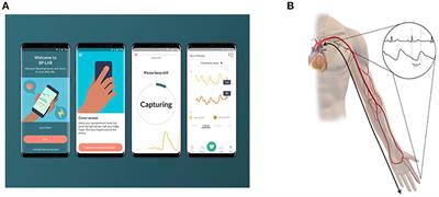 Cuff-Less Methods for Blood Pressure Telemonitoring